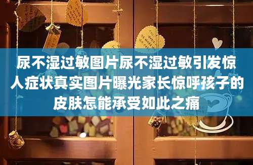 尿不湿过敏图片尿不湿过敏引发惊人症状真实图片曝光家长惊呼孩子的皮肤怎能承受如此之痛